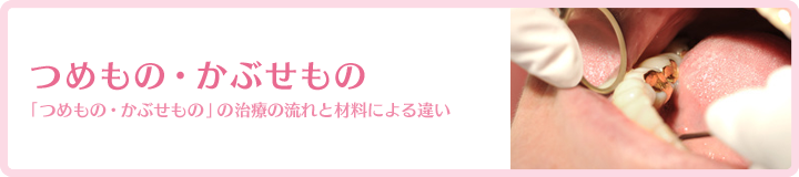 つめもの・かぶせもの