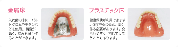 入れ歯に使用する素材