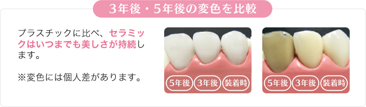 違いその1「美しさ」