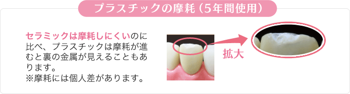 違いその2「耐久性」