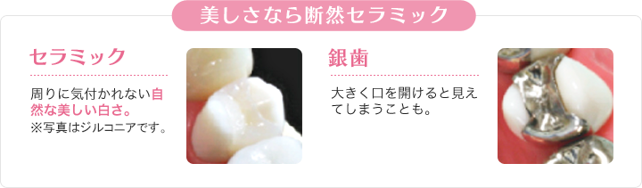 違いその1「美しさ」