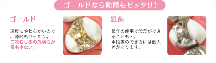 違いその4「再発リスク」