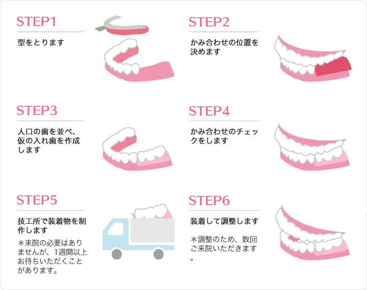 入れ歯治療の流れ